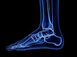 DIGITAL X RAY ANKLE